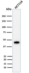 Anti-Cytokeratin 18 antibody [DE-K18] used in Western Blot (WB). GTX34641