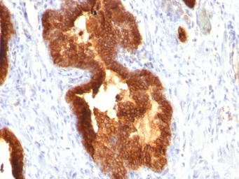 Anti-Cytokeratin 18 antibody [KRT18/835] used in IHC (Paraffin sections) (IHC-P). GTX34643
