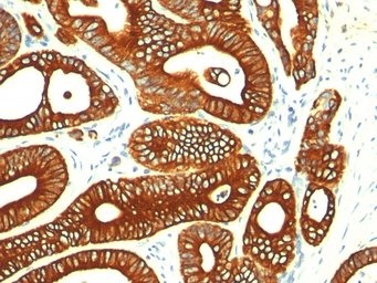 Anti-Cytokeratin 18 antibody [KRT18/835] used in IHC (Paraffin sections) (IHC-P). GTX34643