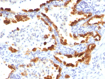 Anti-Cytokeratin 18 antibody [KRT18/835] used in IHC (Paraffin sections) (IHC-P). GTX34643