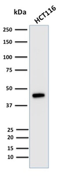 Anti-Cytokeratin 18 antibody [KRT18/835] used in Western Blot (WB). GTX34643