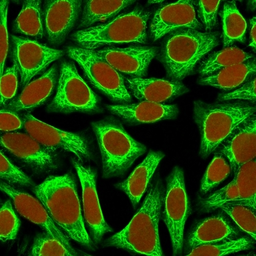 Anti-Cytokeratin 18 antibody [KRT18/836] used in Immunocytochemistry/ Immunofluorescence (ICC/IF). GTX34644