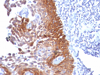 Anti-Cytokeratin 18 antibody [Cocktail] used in IHC (Paraffin sections) (IHC-P). GTX34645