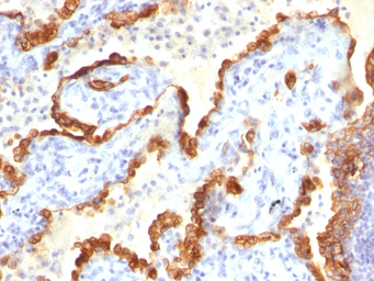 Anti-Cytokeratin 18 antibody [Cocktail] used in IHC (Paraffin sections) (IHC-P). GTX34645