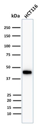 Anti-Cytokeratin 18 antibody [Cocktail] used in Western Blot (WB). GTX34645