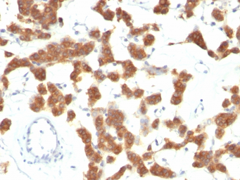 Anti-Cytokeratin 18 antibody [B23.1] used in IHC (Paraffin sections) (IHC-P). GTX34646
