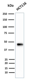 Anti-Cytokeratin 18 antibody [B23.1] used in Western Blot (WB). GTX34646