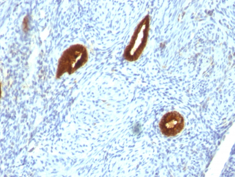 Anti-Cytokeratin 19 antibody [SPM266] used in IHC (Paraffin sections) (IHC-P). GTX34648