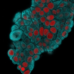 Anti-Cytokeratin 19 antibody [KRT19/800] used in Immunocytochemistry/ Immunofluorescence (ICC/IF). GTX34651