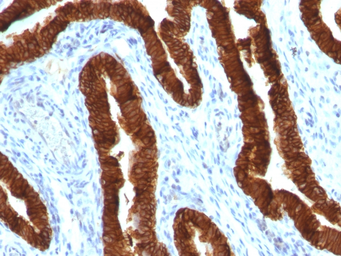 Anti-Cytokeratin 19 antibody [KRT19/800] used in IHC (Paraffin sections) (IHC-P). GTX34651