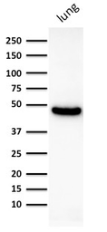 Anti-Cytokeratin 19 antibody [KRT19/800] used in Western Blot (WB). GTX34651