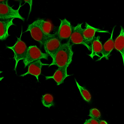 Anti-Cytokeratin 19 antibody [Ks19.1] used in Immunocytochemistry/ Immunofluorescence (ICC/IF). GTX34652