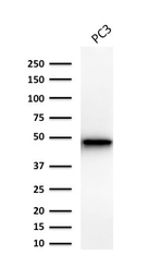 Anti-Cytokeratin 19 antibody [Ks19.1] used in Western Blot (WB). GTX34652