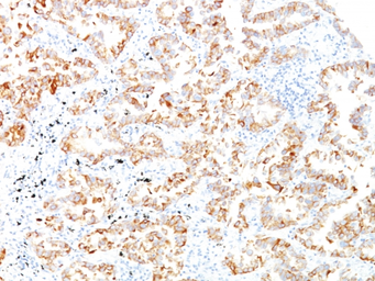 Anti-Cytokeratin 7 antibody [SPM270] used in IHC (Paraffin sections) (IHC-P). GTX34656