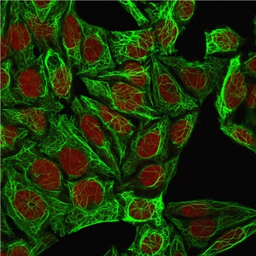 Anti-Cytokeratin 7 antibody [K72.7] used in Immunocytochemistry/ Immunofluorescence (ICC/IF). GTX34657
