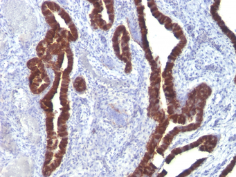 Anti-Cytokeratin 7 antibody [K72.7] used in IHC (Paraffin sections) (IHC-P). GTX34657
