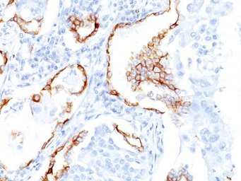 Anti-Cytokeratin 7 antibody [K72.7] used in IHC (Paraffin sections) (IHC-P). GTX34657