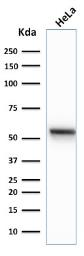 Anti-Cytokeratin 7 antibody [K72.7] used in Western Blot (WB). GTX34657