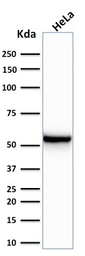 Anti-Cytokeratin 7 antibody [KRT7/760] used in Western Blot (WB). GTX34659