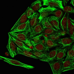 Anti-Cytokeratin 7 antibody [KRT7/1198] used in Immunocytochemistry/ Immunofluorescence (ICC/IF). GTX34660