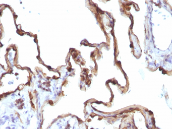 Anti-Cytokeratin 7 antibody [KRT7/1198] used in IHC (Paraffin sections) (IHC-P). GTX34660