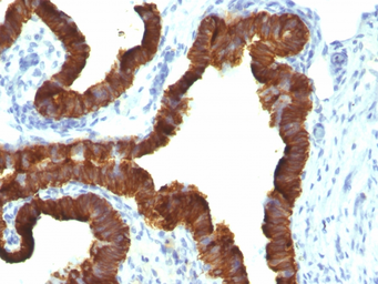 Anti-Cytokeratin 7 antibody [KRT7/1198] used in IHC (Paraffin sections) (IHC-P). GTX34660