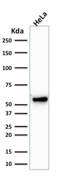 Anti-Cytokeratin 7 antibody [KRT7/1198] used in Western Blot (WB). GTX34660