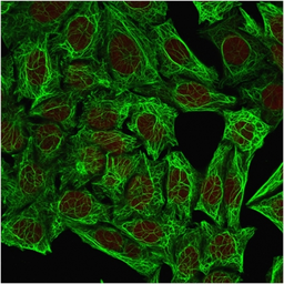Anti-Cytokeratin 7 antibody [OV-TL12/30] used in Immunocytochemistry/ Immunofluorescence (ICC/IF). GTX34662