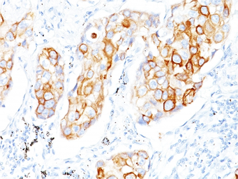 Anti-Cytokeratin 7 antibody [OV-TL12/30] used in IHC (Paraffin sections) (IHC-P). GTX34662