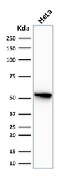 Anti-Cytokeratin 7 antibody [OV-TL12/30] used in Western Blot (WB). GTX34662