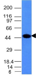 Anti-Cytokeratin 8 antibody [H1] used in Western Blot (WB). GTX34663