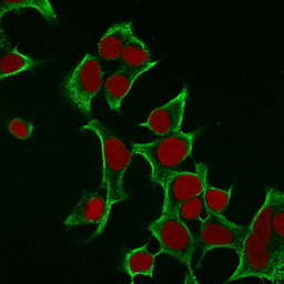 Anti-Cytokeratin 8 antibody [B22.1] used in Immunocytochemistry/ Immunofluorescence (ICC/IF). GTX34664