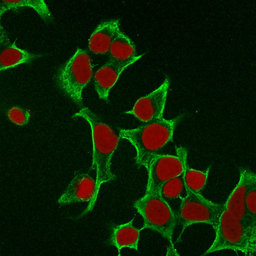 Anti-Cytokeratin 8 antibody [B22.1] used in Immunocytochemistry/ Immunofluorescence (ICC/IF). GTX34664