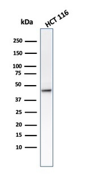 Anti-Cytokeratin 8 antibody [B22.1] used in Western Blot (WB). GTX34664