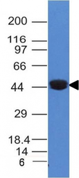 Anti-Cytokeratin 8 antibody [K8/383] used in Western Blot (WB). GTX34666
