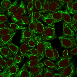 Anti-Cytokeratin 8 antibody [TS1] used in Immunocytochemistry/ Immunofluorescence (ICC/IF). GTX34667