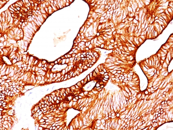 Anti-Cytokeratin 8 antibody [TS1] used in IHC (Paraffin sections) (IHC-P). GTX34667