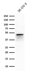 Anti-Cytokeratin 8 antibody [TS1] used in Western Blot (WB). GTX34667