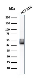 Anti-Cytokeratin 8 antibody [KRT8/803] used in Western Blot (WB). GTX34671