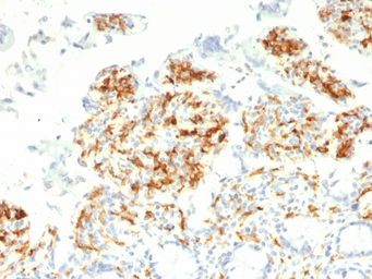 Anti-DC-SIGN antibody [C209/1781] used in IHC (Paraffin sections) (IHC-P). GTX34673