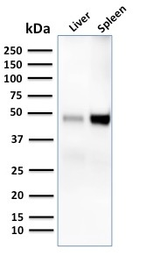 Anti-DC-SIGN antibody [C209/1781] used in Western Blot (WB). GTX34673