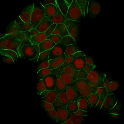 Anti-E-Cadherin antibody [CDH1/1525] used in Immunocytochemistry/ Immunofluorescence (ICC/IF). GTX34680