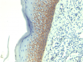 Anti-E-Cadherin antibody [CDH1/1525] used in IHC (Paraffin sections) (IHC-P). GTX34680