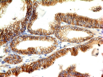 Anti-E-Cadherin antibody [CDH1/1525] used in IHC (Paraffin sections) (IHC-P). GTX34680