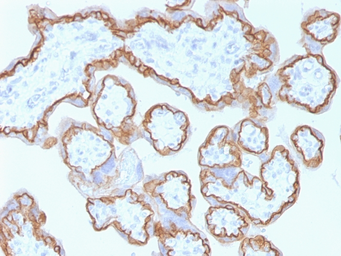 Anti-E-Cadherin antibody [CDH1/1525] used in IHC (Paraffin sections) (IHC-P). GTX34680