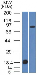 Anti-E-Cadherin antibody [CDH1/1525] used in Western Blot (WB). GTX34680
