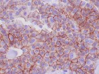 Anti-E-Cadherin antibody [CDH1/1525] used in IHC (Paraffin sections) (IHC-P). GTX34680