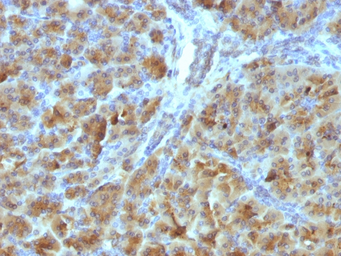 Anti-Elastase 3B antibody [CELA3B/1257] used in IHC (Paraffin sections) (IHC-P). GTX34687
