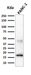 Anti-Elastase 3B antibody [CELA3B/1257] used in Western Blot (WB). GTX34687