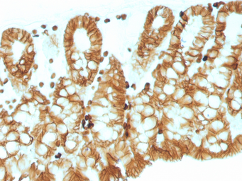 Anti-EpCAM antibody [EGP40/1110] used in IHC (Paraffin sections) (IHC-P). GTX34691